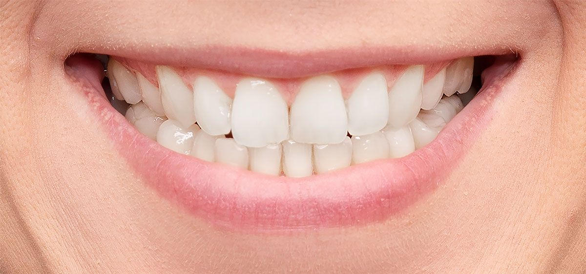 close up of white teeth